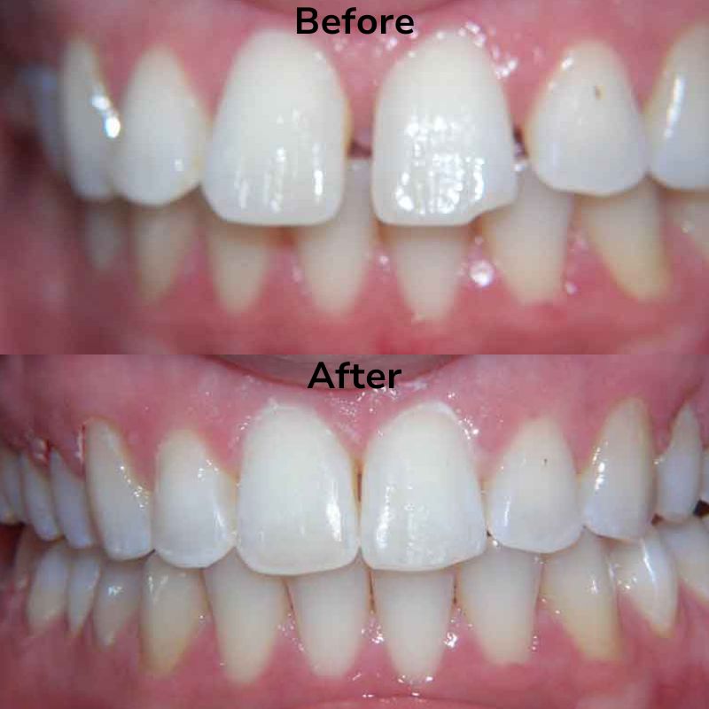 Summit Dental Group Smile Gallery