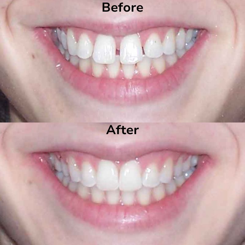 Summit Dental Group Smile Gallery