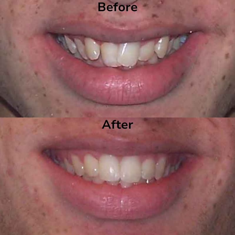 Summit Dental Group Smile Gallery