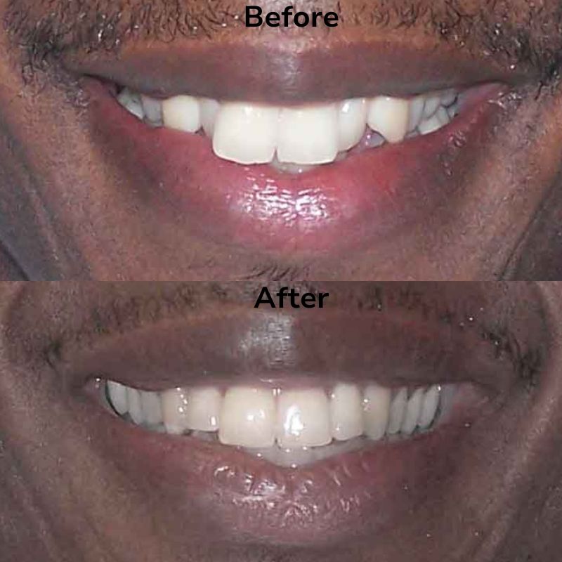 Summit Dental Group Smile Gallery