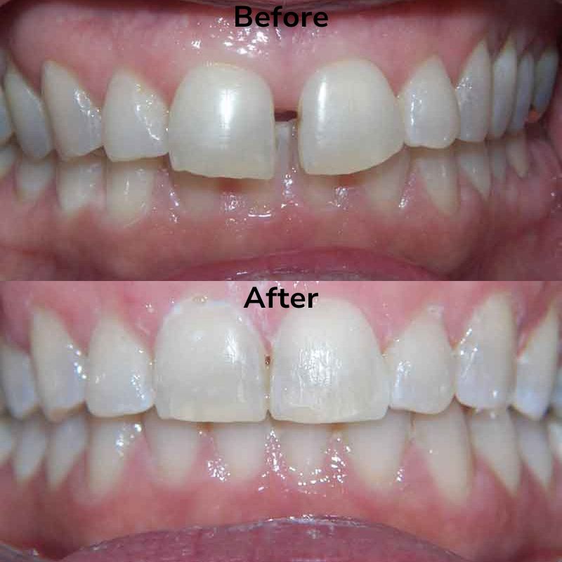 Summit Dental Group Smile Gallery