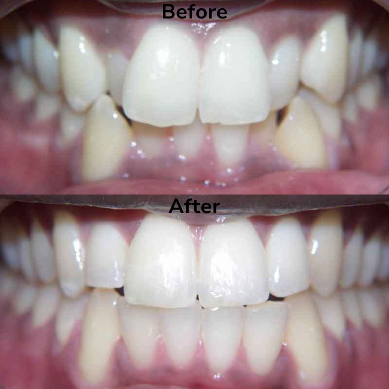 Summit Dental Group Smile Gallery