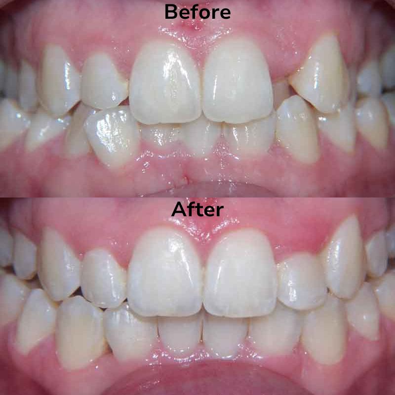 Summit Dental Group Smile Gallery