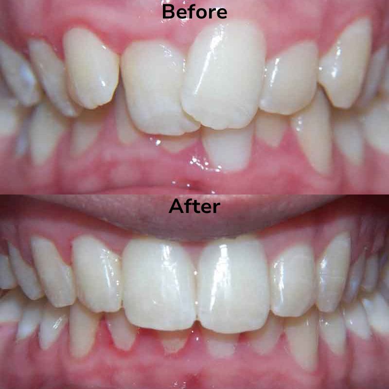 Summit Dental Group Smile Gallery