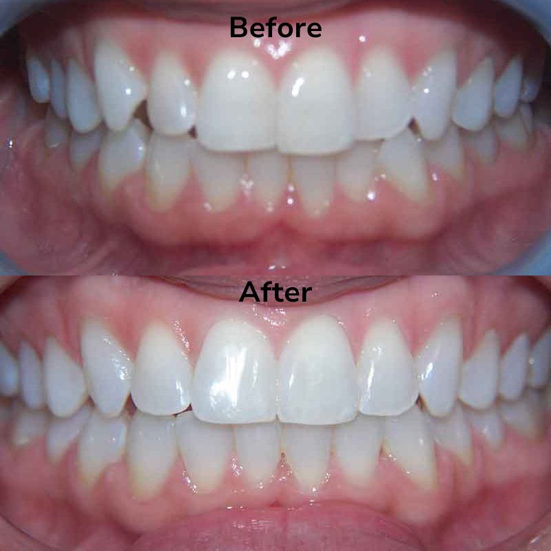 Summit Dental Group Smile Gallery