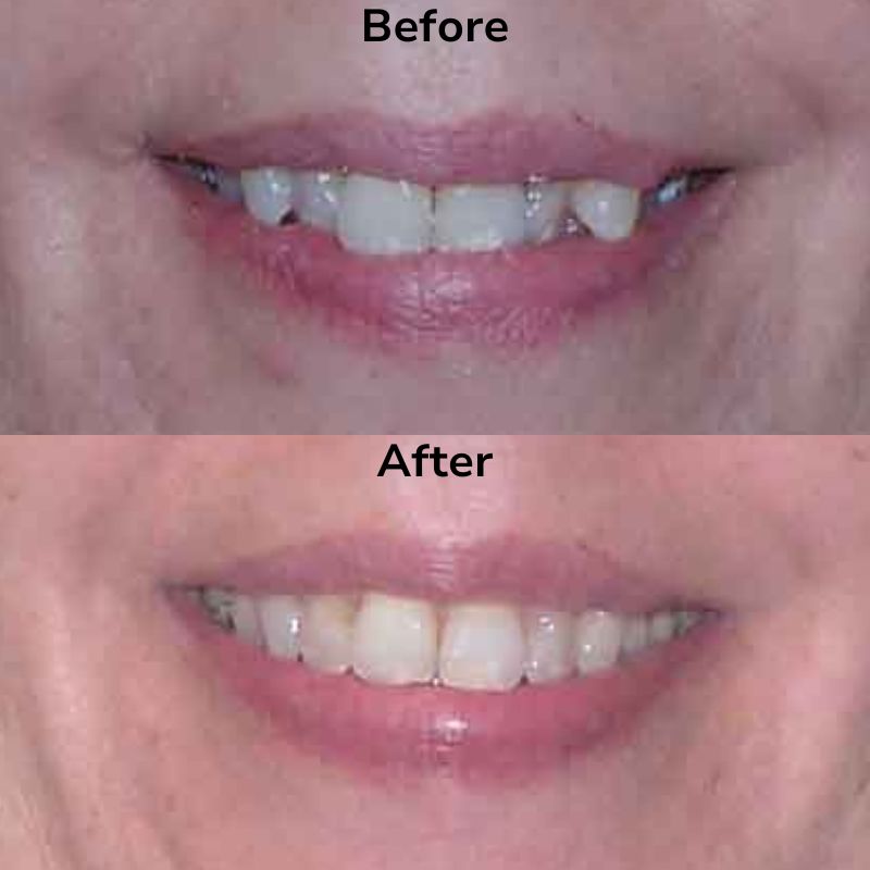 Summit Dental Group Smile Gallery