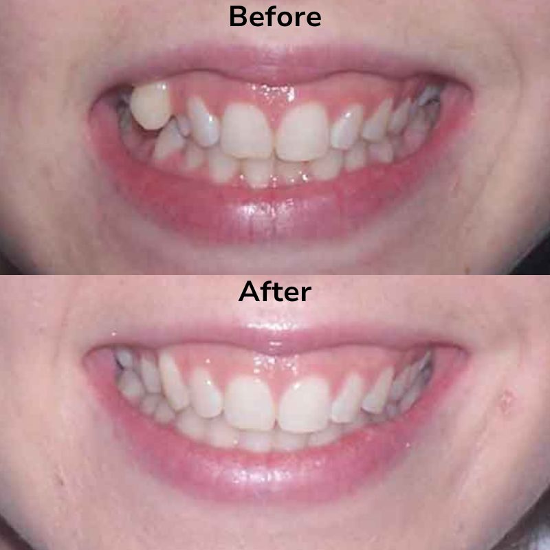 Summit Dental Group Smile Gallery