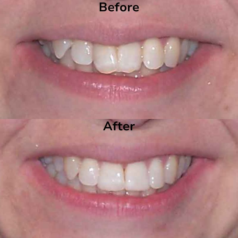 Summit Dental Group Smile Gallery