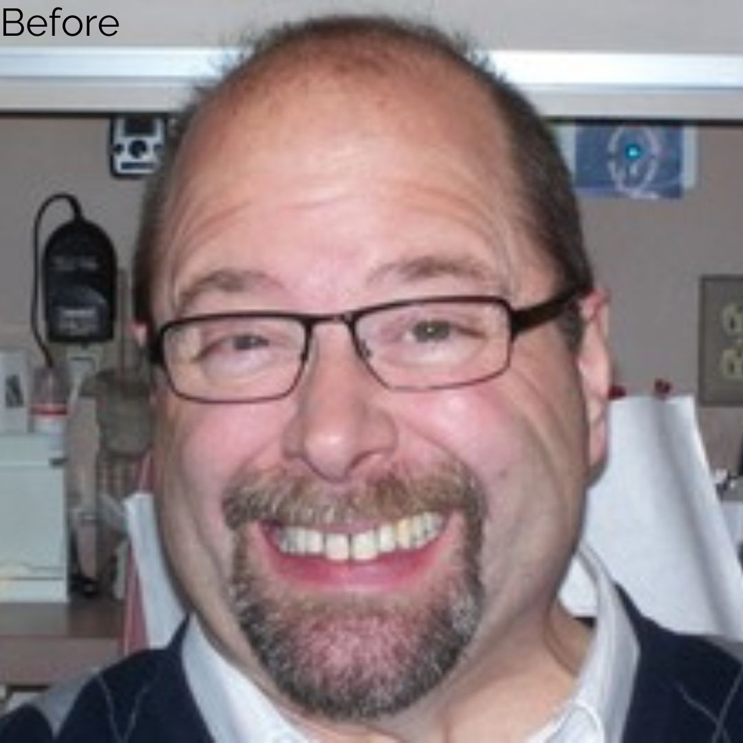Before treatment at Summit Dental Group